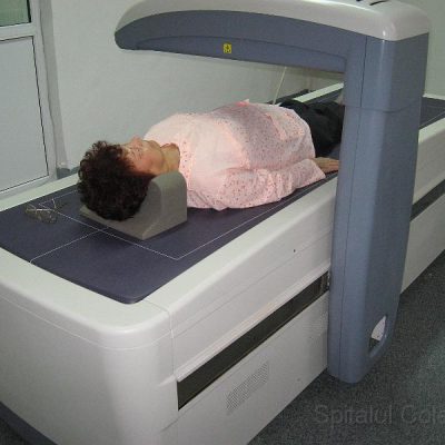 DEXA