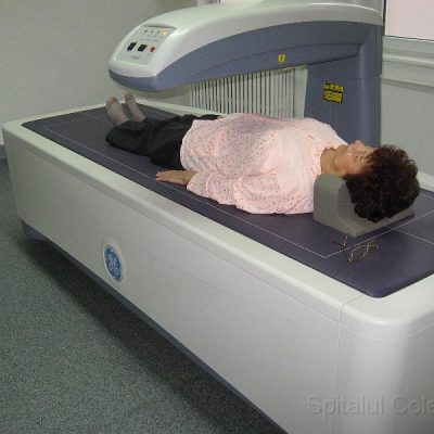 DEXA