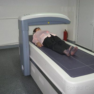 DEXA